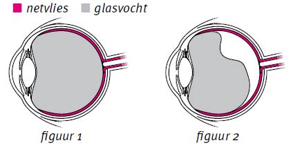 glasvochtloslating.